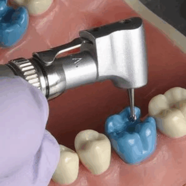 Waldent Contra-angle Handpiece 11