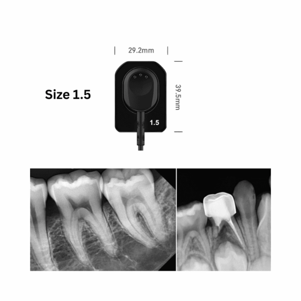 Vatech ez sensor imaging